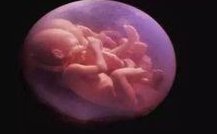 女性不孕检查需要空腹吗？有哪些注意事项？