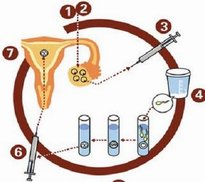 43岁患者成功生下试管双胞胎，全靠做对了这几件事！